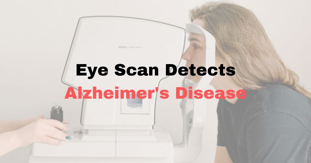 Eye Scan Detects Alzheimer’s Disease