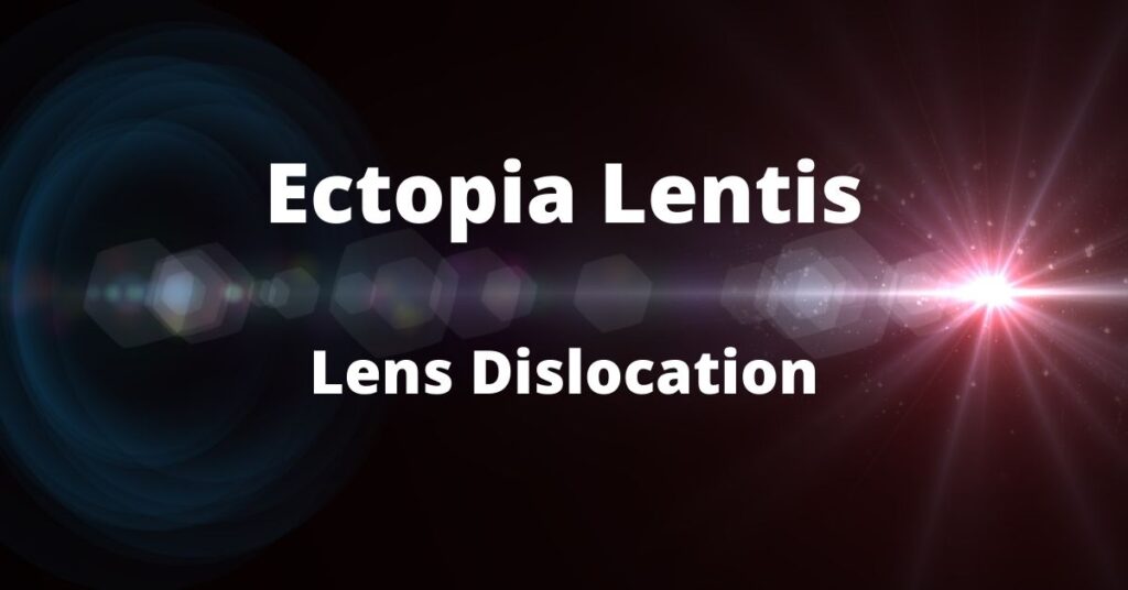 Featured Image Lens Dislocation